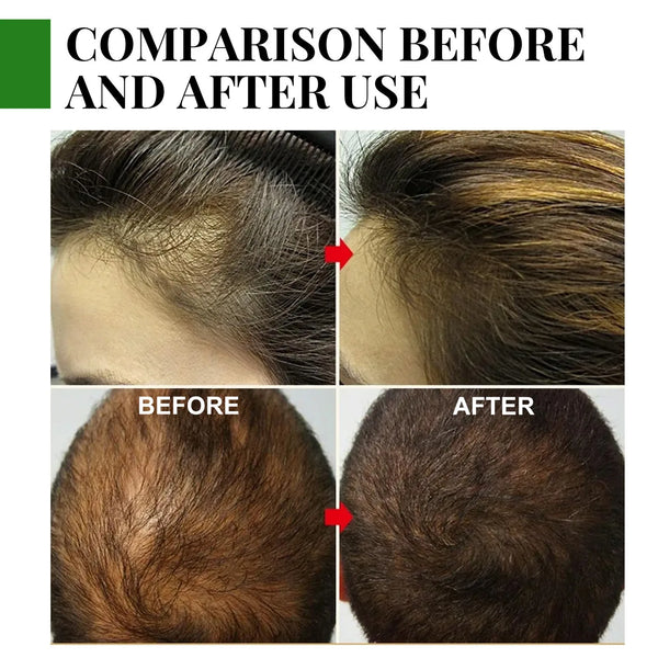 Rosemary Essential Oil Hair Growth Oils Pure Natural 30ML Hair